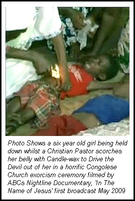 Photo showing Christian women holding down children in the Congo 
whilst a Christian Pastor Scorches Belly of a Six Year Old With Candlewax to Chase Demons out of Her 