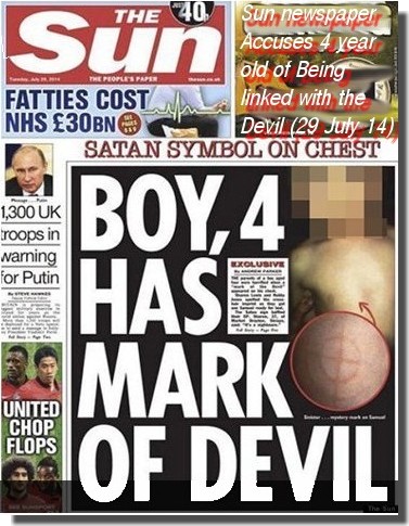 The Sun newspaper harranged by politicians and the twitterati for publishing a photo of a boy with the Devil's Mark 29th July 2014